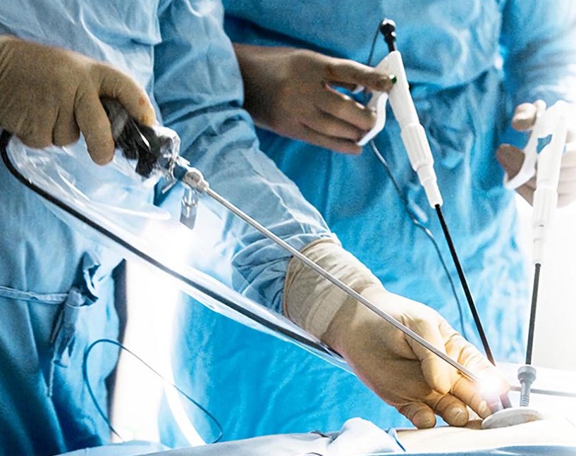 Laparoscopic Surgery