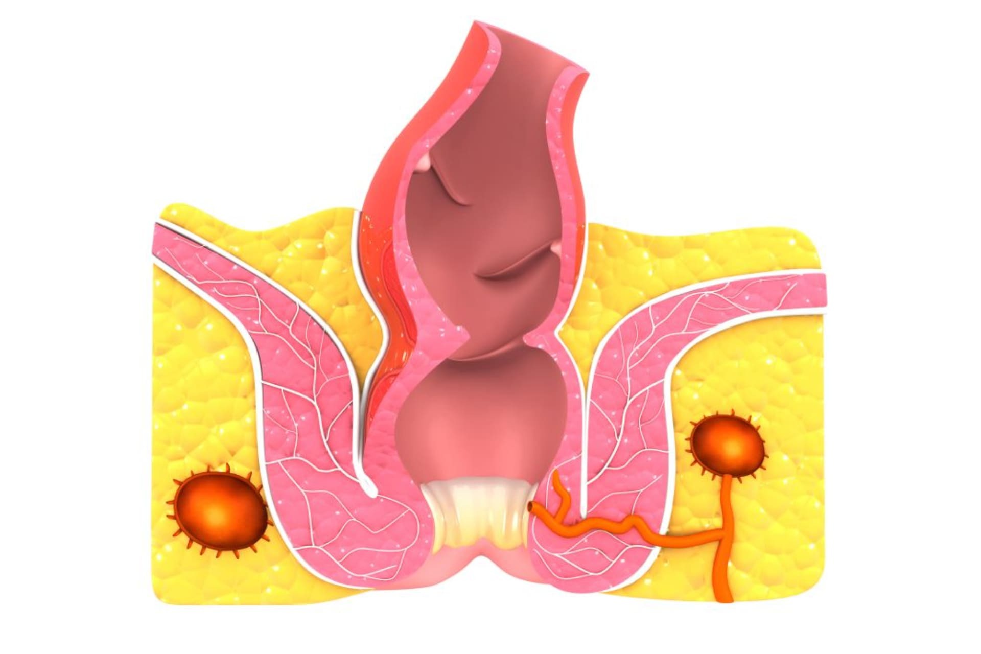 Perianal Apse