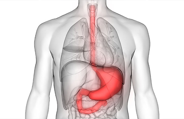 Esophageal Cancer